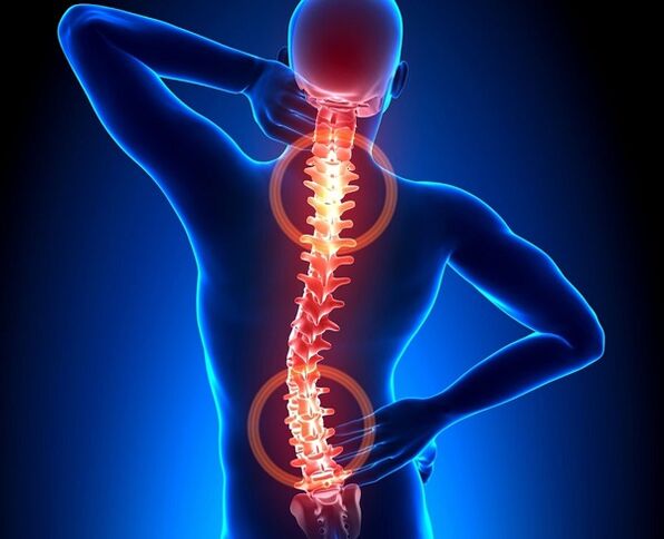 douleur dans la colonne vertébrale avec ostéochondrose